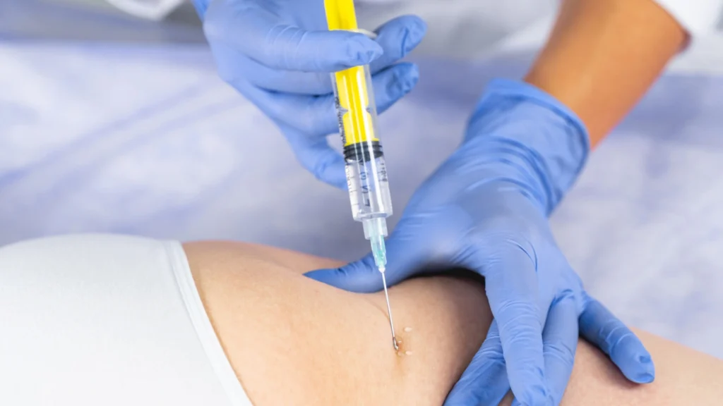 Aesthetic lipolysis differs from natural lipolysis in proteolysis and lipolysis.
