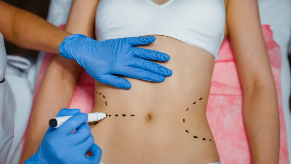 Know the key difference between Ketogenesis vs lipolysis vs Ketosis.
