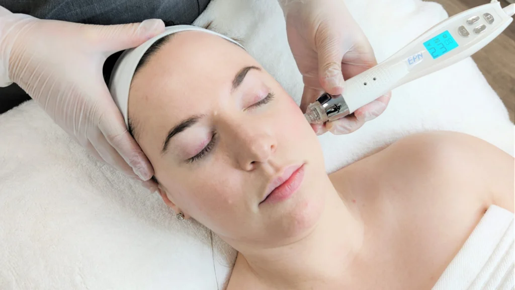 Know average cost of microneedling toronto full treatment package.