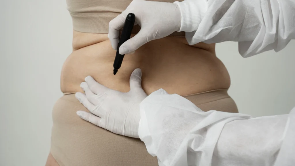 Proteolysis and lipolysis support different metabolic functions during weight loss.