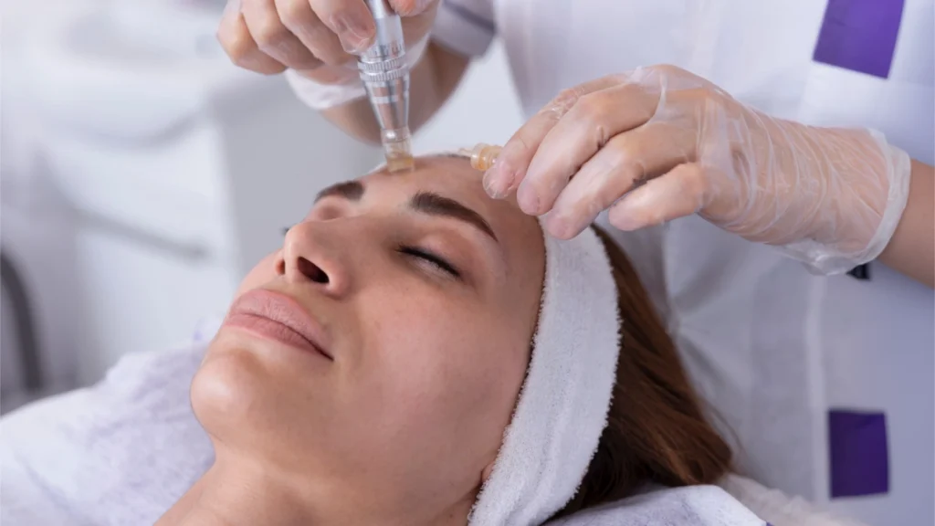 Serum with microneedling Toronto cost.