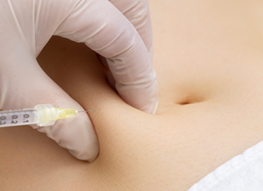 Lipolysis
