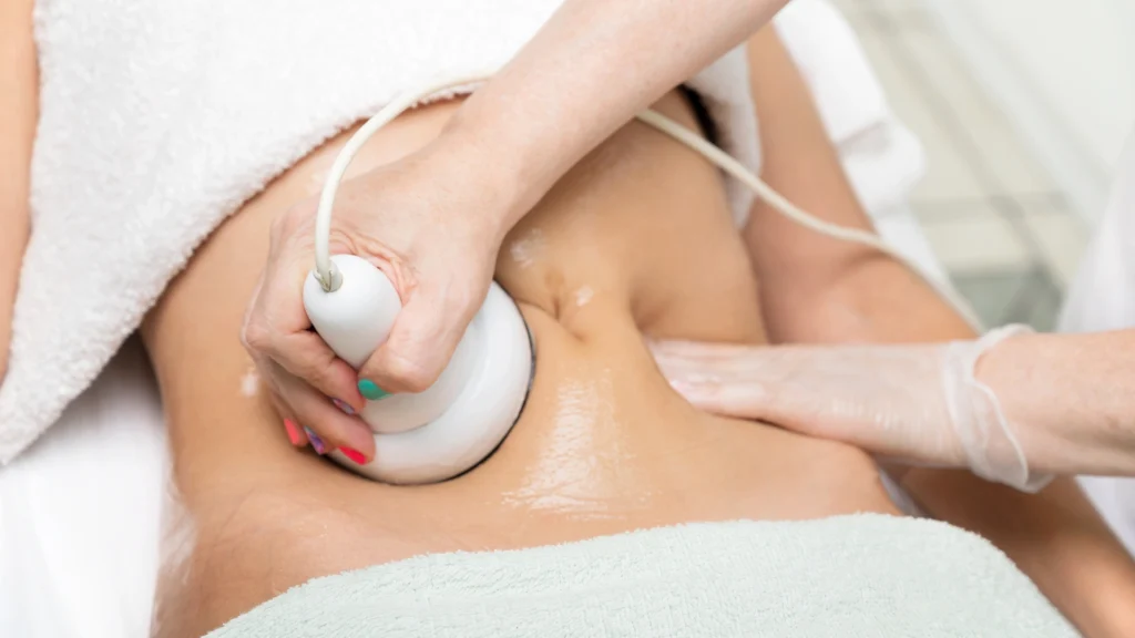 The body processes affected fat cells after ultrasound lipolysis.
