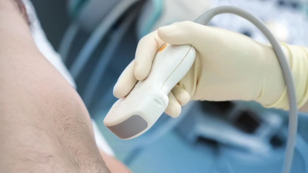 Ultrasound lipolysis during the procedure.