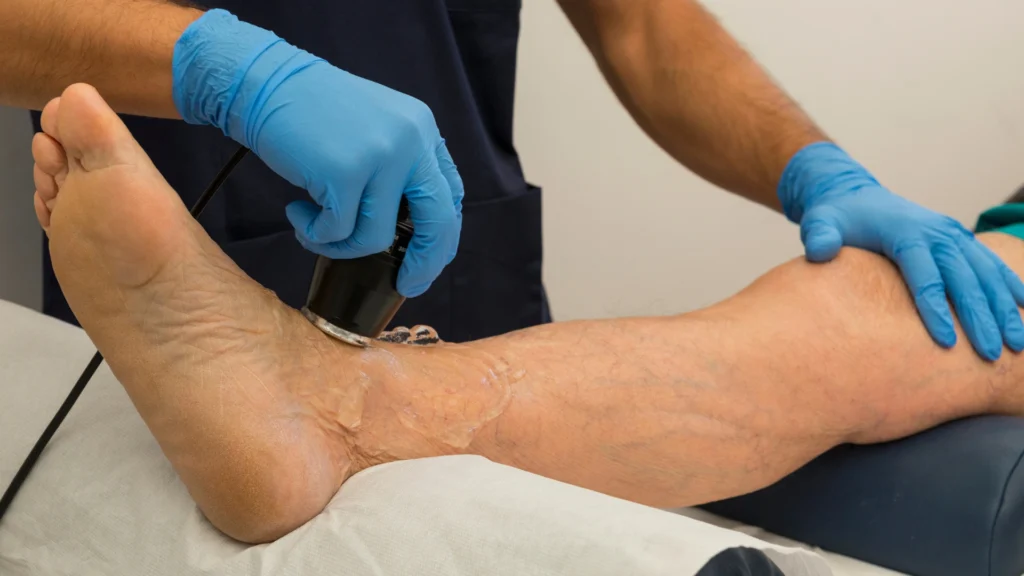 Invasive ultrasound lipolysis treatment.