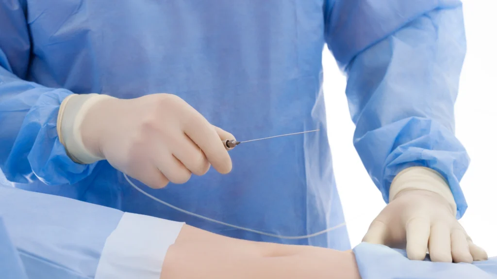 Learn what is laser lipolysis.