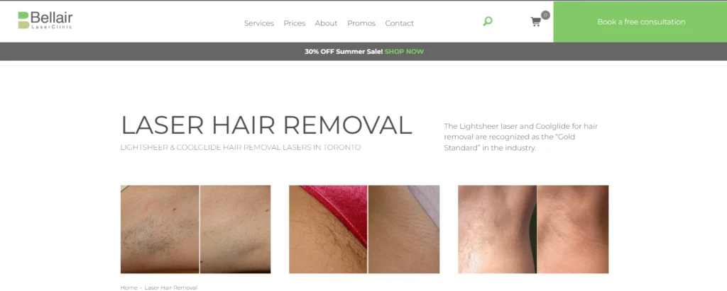 Bellair Laser Clinic - back laser hair removal near me in Toronto.