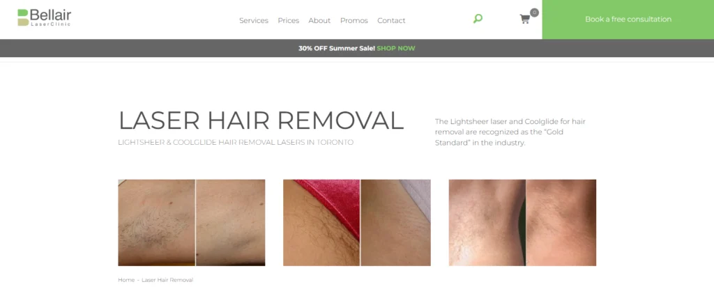 Bellair Laser Clinic - laser hair removal clinic near Yonge and Eglinton.