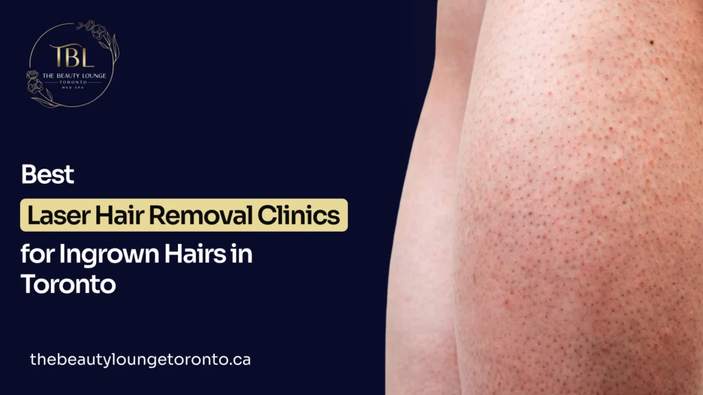 7 Best Laser Hair Removal Clinics for Ingrown Hairs in Toronto