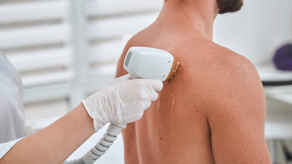 Choosing a laser hair removal clinic near Avenue Road in Toronto.