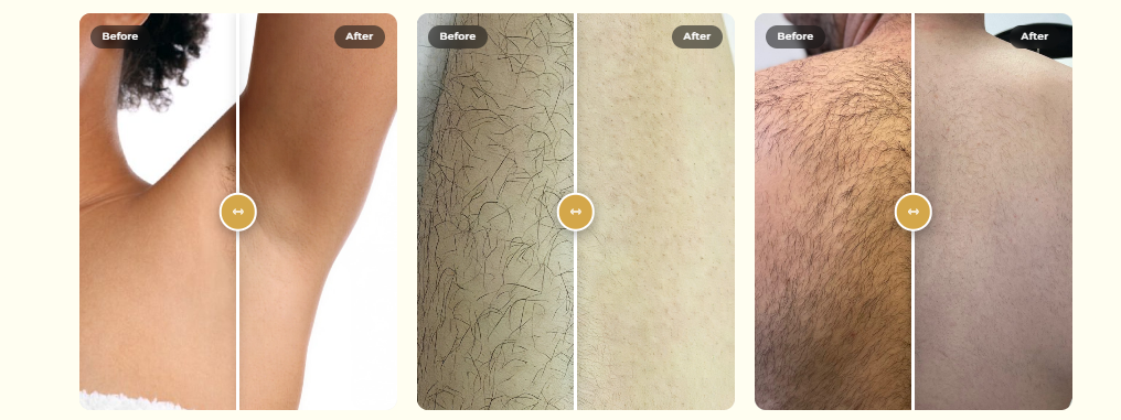 The Beauty Lounge Toronto - laser hair removal clinics for full back in Toronto.
